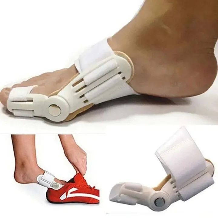 Foot Bone Correction for Relief of Thumb Valgus Toe Corrector Night Toe Splitter Adjustment Toe Foot Tool Bunion Splint - Oshi.pk - Buy & Sell Online