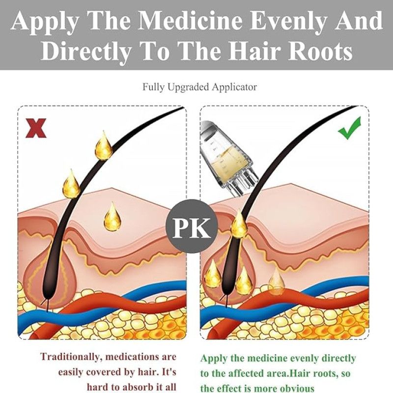 Mini Portable Oil Scalp Applicator Hair Oil Applicator Bottle Scalp Massager - Oshi.pk - Buy & Sell Online