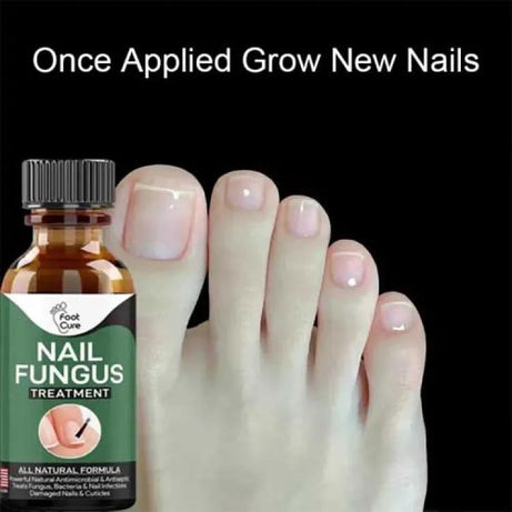 Nail Fungus Treatment Stop Fungal Growth Effective Fingernail 10ml - Oshi.pk - Buy & Sell Online
