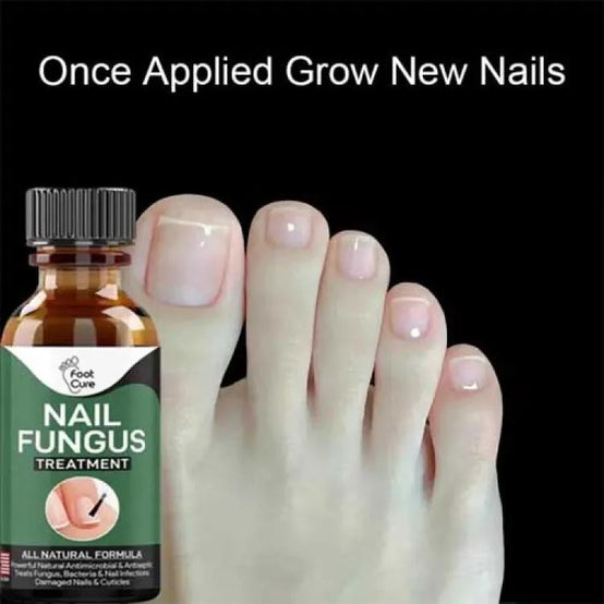 Nail Fungus Treatment Stop Fungal Growth Effective Fingernail 10ml - Oshi.pk - Buy & Sell Online