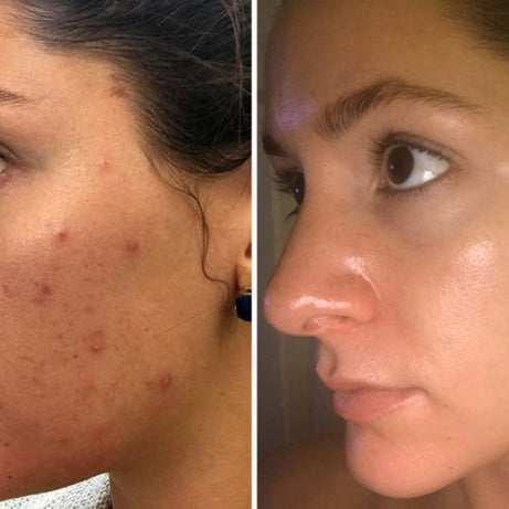 Sandal Emergency Whitening Serum Urgent whitening - Oshi.pk - Buy & Sell Online