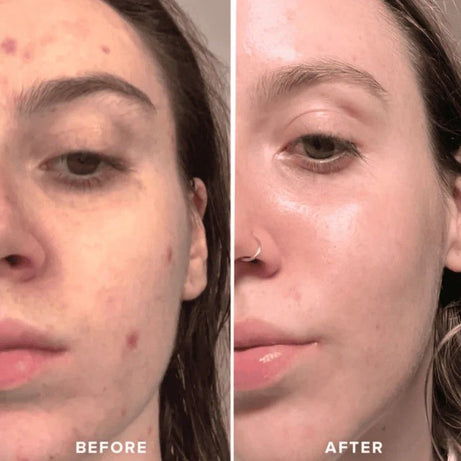 Silicon Ice Cube Face Roller - Oshi.pk - Buy & Sell Online