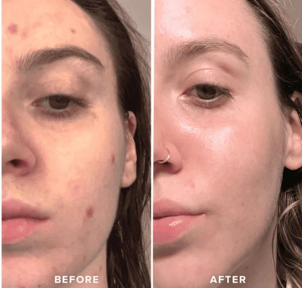 Silicon Ice Cube Face Roller - Oshi.pk - Buy & Sell Online