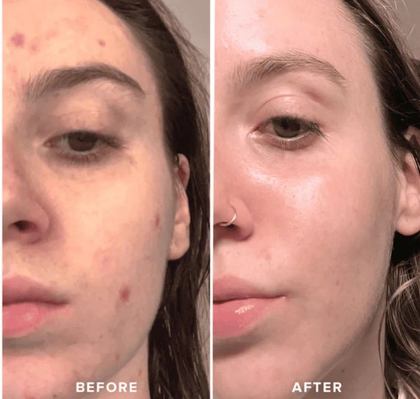 Silicon Ice Cube Face Roller - Oshi.pk - Buy & Sell Online