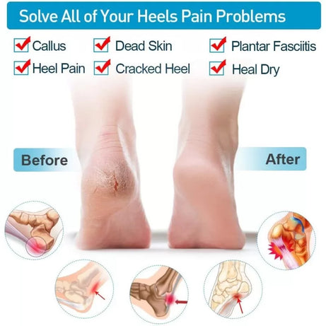 Silicone Gel Heel Pad Socks for Pain Relief and anti crack - Oshi.pk - Buy & Sell Online