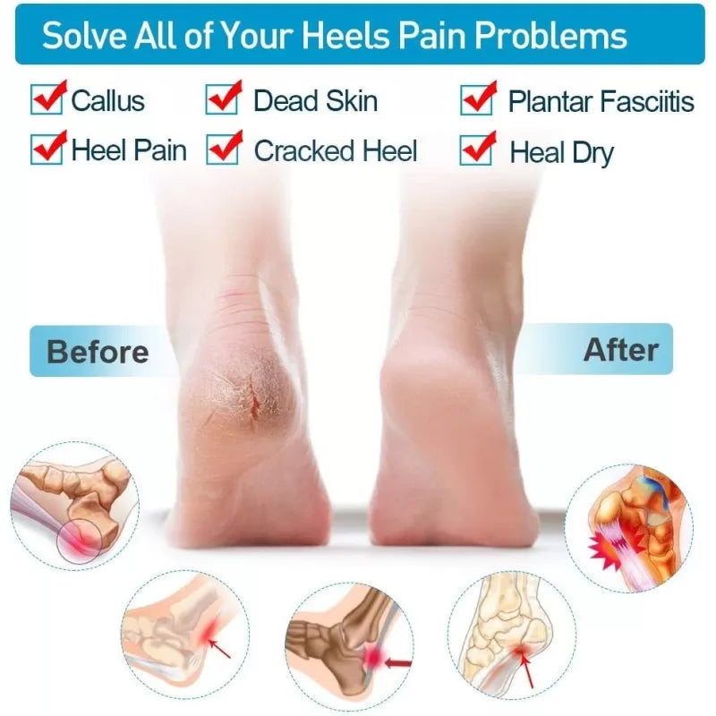 Silicone Gel Heel Pad Socks for Pain Relief and anti crack - Oshi.pk - Buy & Sell Online
