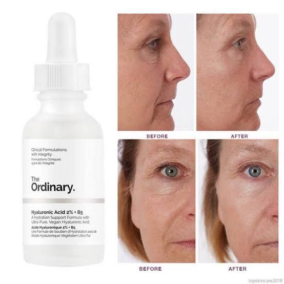 The Ordinary Hyaluronic Acid 2% + B5 Serum - 30ML - Oshi.pk - Buy & Sell Online