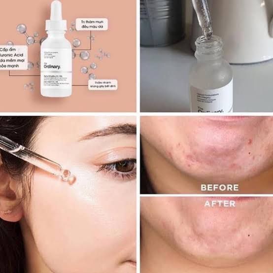 The Ordinary Hyaluronic Acid 2% + B5 Serum - 30ML - Oshi.pk - Buy & Sell Online