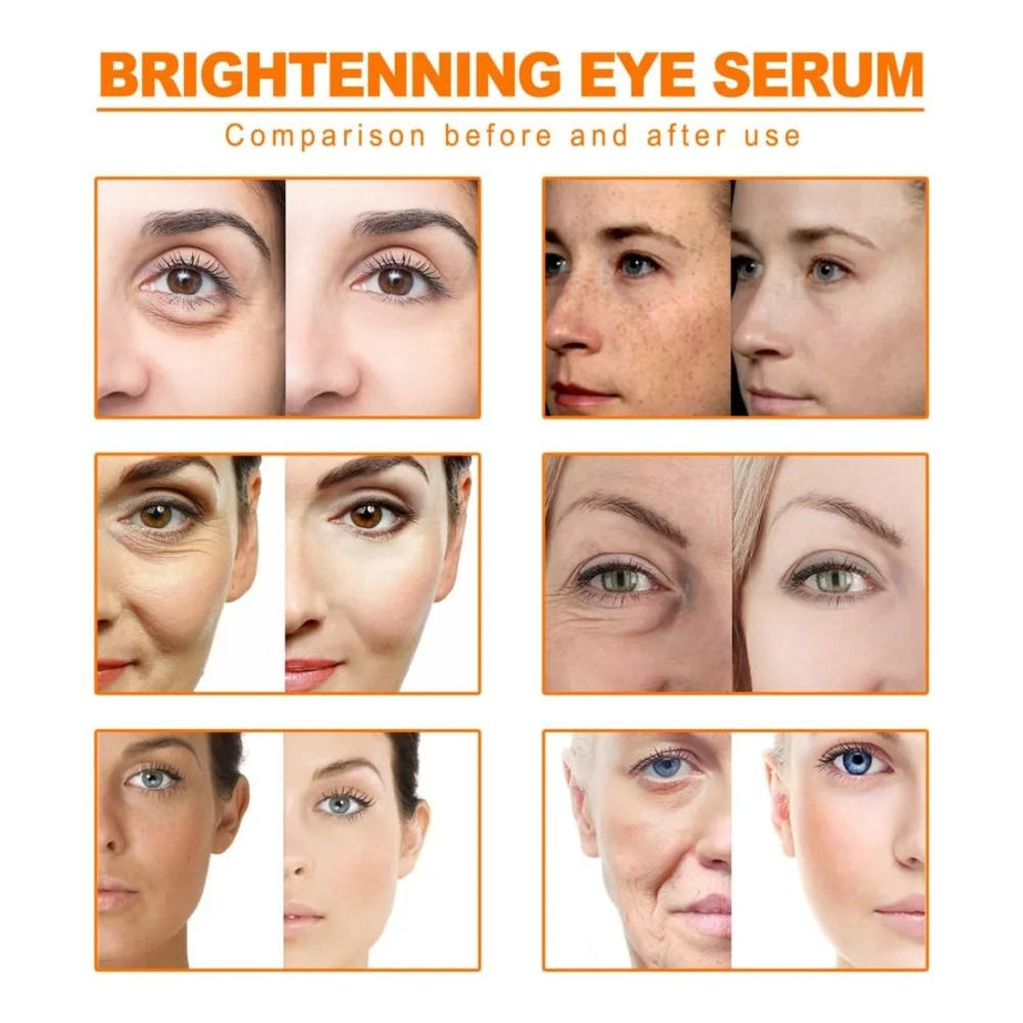 TURMERIC ANTI AGING OIL REMOVE DARK SPOTS - Oshi.pk - Buy & Sell Online