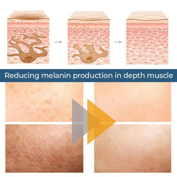 TURMERIC ANTI AGING OIL REMOVE DARK SPOTS - Oshi.pk - Buy & Sell Online