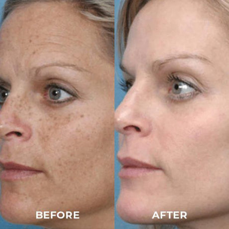 TURMERIC ANTI AGING OIL REMOVE DARK SPOTS - Oshi.pk - Buy & Sell Online