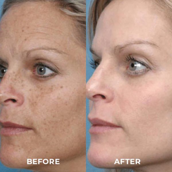 TURMERIC ANTI AGING OIL REMOVE DARK SPOTS - Oshi.pk - Buy & Sell Online