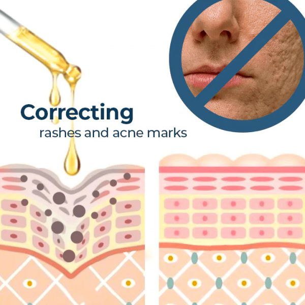 TURMERIC ANTI AGING OIL REMOVE DARK SPOTS - Oshi.pk - Buy & Sell Online