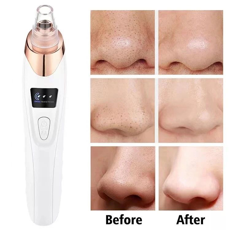 Upgraded Blackhead Remover Vacuum Facial Pore Cleaner Electric Acne Comedone Whitehead Extractor Tool 5 Probes For Women And Men - Oshi.pk - Buy & Sell Online
