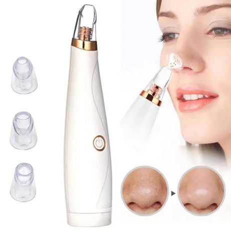 Blackhead Remover Vacuum Pore Cleaner